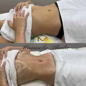 LinfoModellante® (per area)